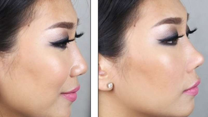 Blogger kecantikan Raiza Contawi mencoba Nose Lifters