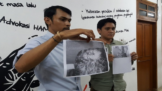 Aktivis Kontras Arif Nurfikri memegang foto korban kekerasa aparat