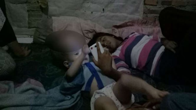 Ilham Putra Usman, bocah berusia tiga tahun penderita penyakit hidrosefalus, warga Kampung Ranjeng, Desa Ranjeng, Kecamatan Ciruas, Kabupaten Serang, Banten.