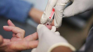 Stroke, Penyakit yang Banyak Diderita di Indonesia