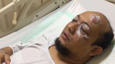 Kondisi Novel Baswedan usai disiram air keras.