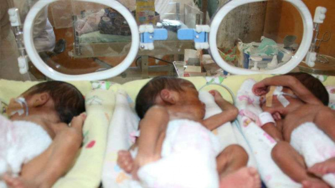 Tiga bayi perempuan kembar Viona, Viony, dan Viola lahir prematur di Rumah Sakit Umum Daerah Sungai Dareh, Dharmasraya, Sumatera Barat.