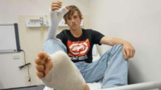 Pria di Australia setuju jempol kaki dijadikan jempol tangan