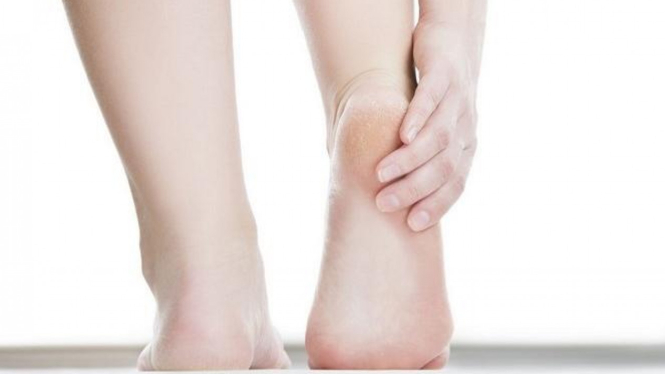 Tips Alami Atasi Tumit Kaki Pecah Pecah Karena Pakai Heels