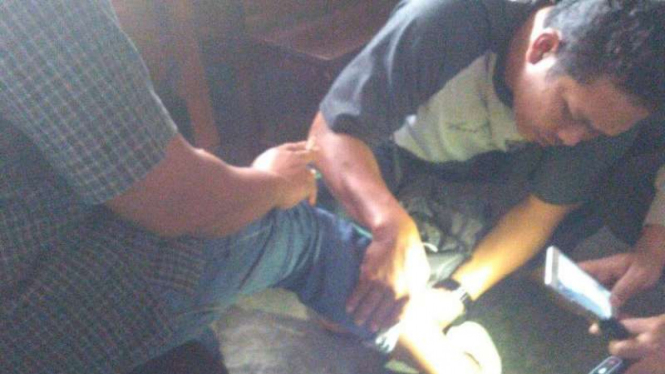 Korban penembakan di Bantul, memperlihatkan lukanya.