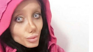 Wanita Ini Berbohong Mengaku Oplas Demi Mirip Jolie