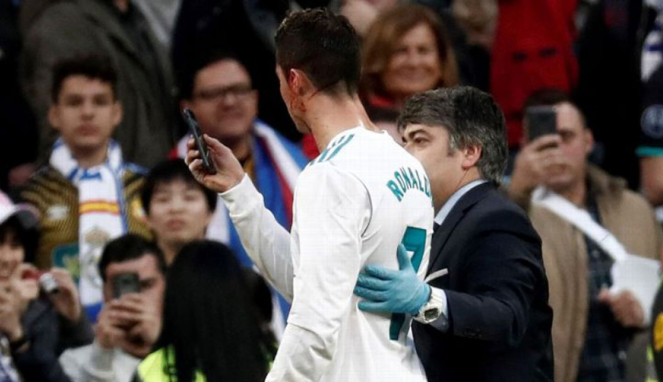 Megabintang Real Madrid, Cristiano Ronaldo, saat cek luka di kepalanya dengan HP