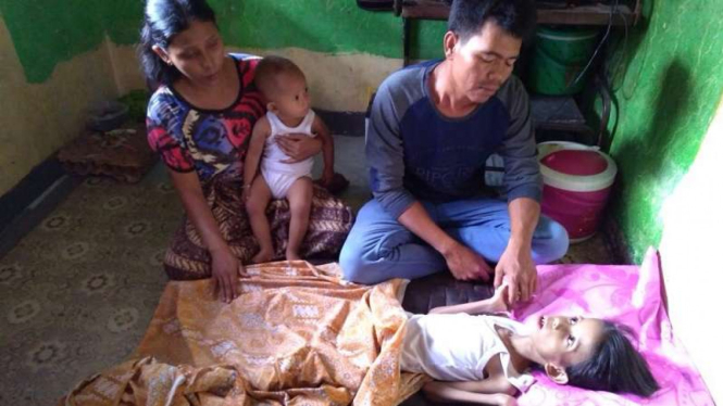 Bocah 7 tahun asal Padang menderita gizi buruk