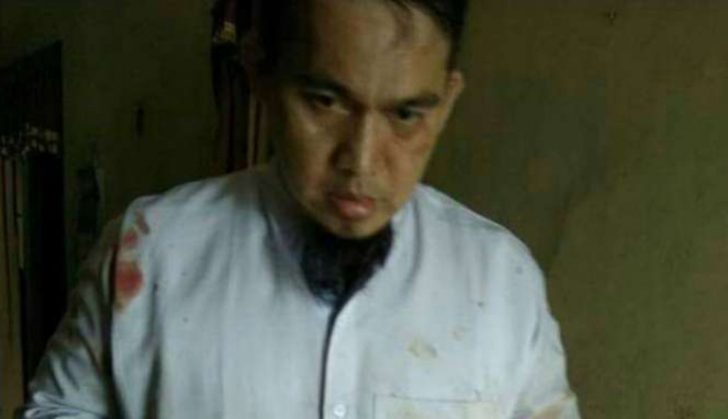 Ustadz Suryadinsyah, korban penganiyaan di Aceh. Pelaku adalah orang gila.