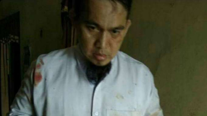 Ustadz Suryadinsyah, korban penganiyaan di Aceh. Pelaku adalah orang gila.