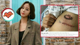 Aktris K-Pop jadi Korban Malpraktik, Kulitnya Berantakan
