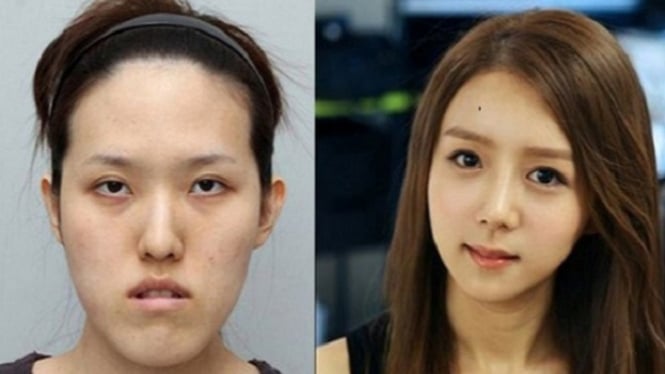 Mengejutkan 10 Wajah Asli Wanita Korea Tanpa Operasi Plastik