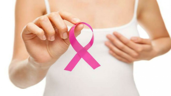 Ilustrasi kanker payudara.