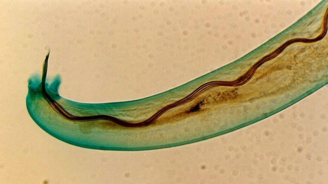 Gambar cacing Angiostrongylus cantonensis yang diperbesar