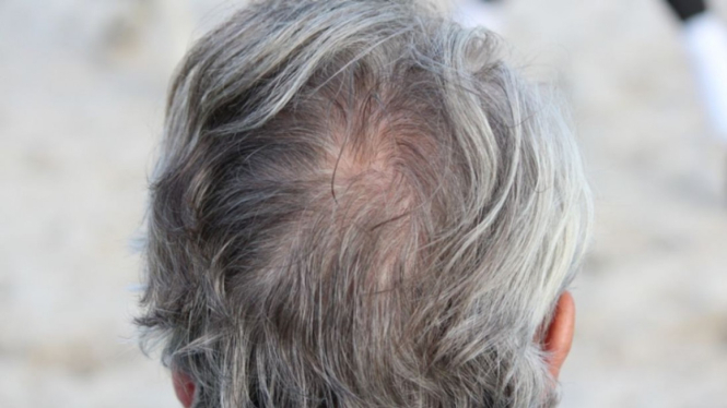 Ilustrasi kepala dengan rambut putih