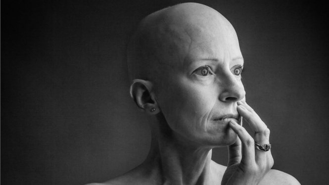 Liz O`Riordan pertama kali didiagnosis kanker payudara pada tahun 2015. - Alex Kilbee