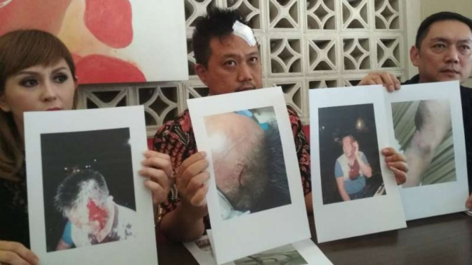 Rudy Wibowo (tengah), caleg Partai Perindo korban penganiayaan, dan kuasa hukumnya memberikan keterangan kepada wartawan di Surabaya, Jawa Timur, pada Senin, 29 April 2019.