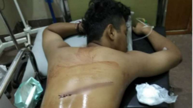 Korban aksi brutal geng motor di Kampung Lio, Depok, Jawa Barat.