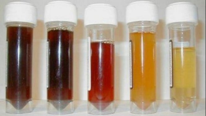 Ilustrasi warna urine.