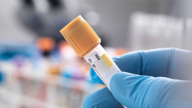 Semakin banyaknya orang yang menjalani tes dan menjalani perawatan membuat angka penularan HIV di Australia terus menurun.
