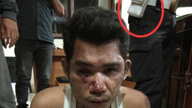 Zainal Abidin tewas dikeroyok polisi