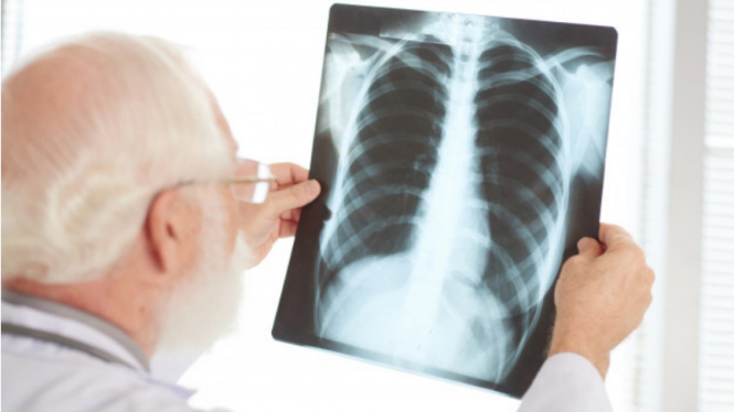 Ilustrasi paru-paru/rontgen/x-ray.
