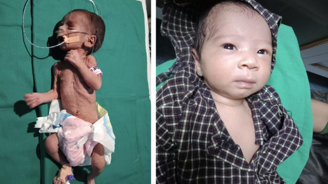 Sempat kritis saat diselamatkan dari dalam tanah, kesehatan bayi prematur itu kini dinyatakan normal. - Dr Ravi Khanna