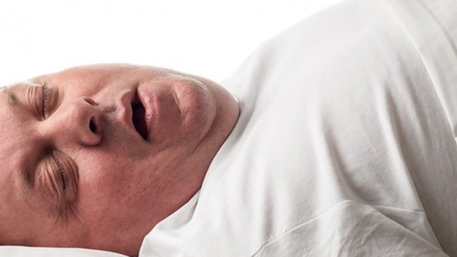 Apnea tidur bisa menimbulkan suara mendengkur yang keras dan berisik di malam hari. - SCIENCE PHOTO LIBRARY