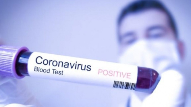 Ilustrasi Virus Corona.