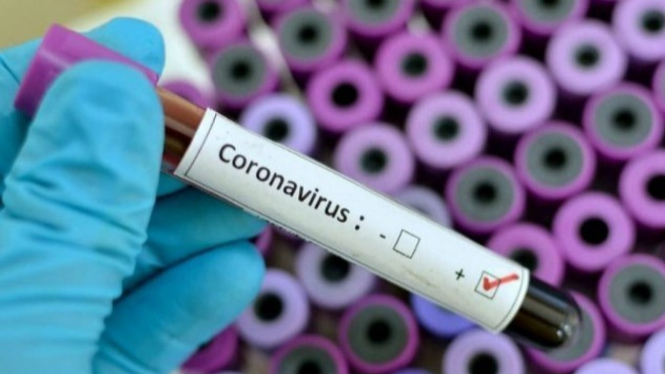 Virus Corona.