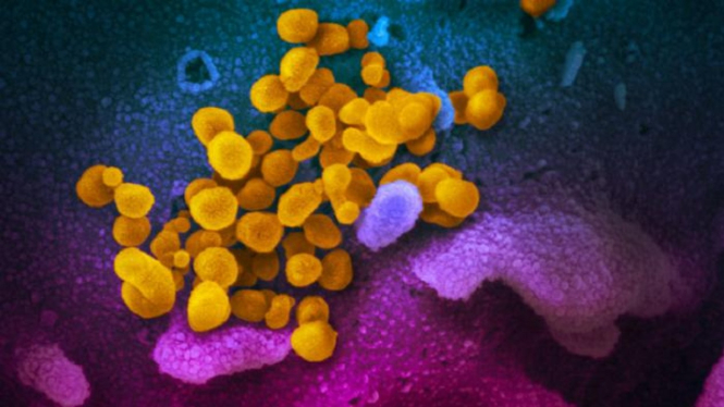 Gambar pemindaian dengan Mikroskop Elektron, yang menunjukkan Virus Corona (kuning) diantara sel manusia (selain warna kuning). (Image Credit: NIAID-RML)