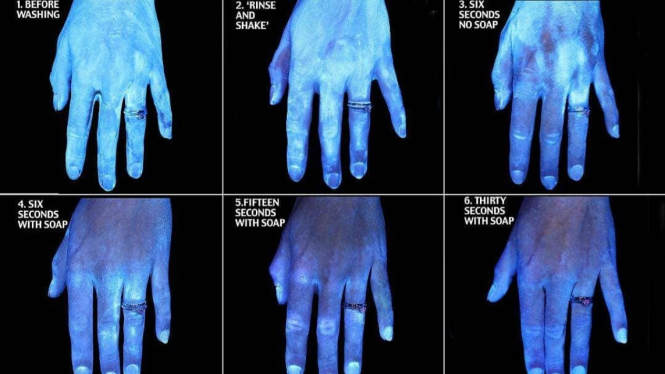 Aktris Sabun Foto Ini Perlihatkan Perbedaan Ekstrem Tangan yang Dicuci 