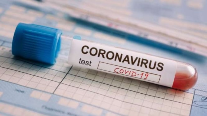 Sampel tes Virus Corona atau COVID-19