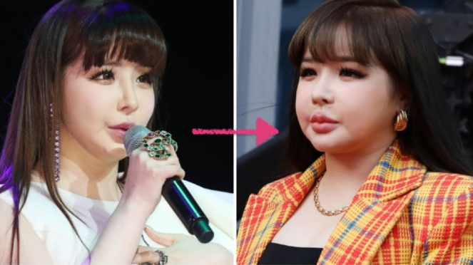 Park Bom eks 2NE1.