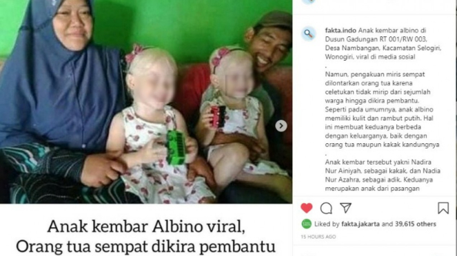 Viral anak kembar albino di Wonogiri
