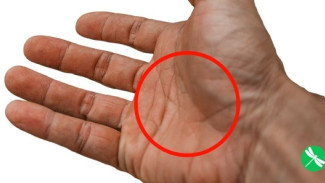 Terungkap! Misteri Garis 'X' di Telapak Tangan, Ini Artinya