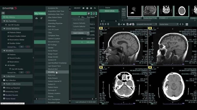 Alat CT Scan (Computed Tomography scan) dengan PACS
