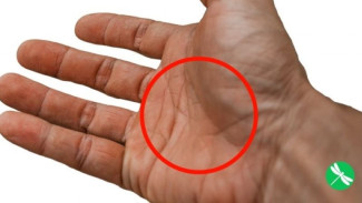 Misteri Huruf 'X' di Telapak Tangan, Akhirnya Terungkap!