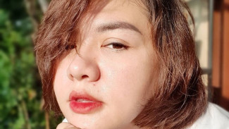 Terungkap, Vicky Shu Hampir Mau Operasi Wajah