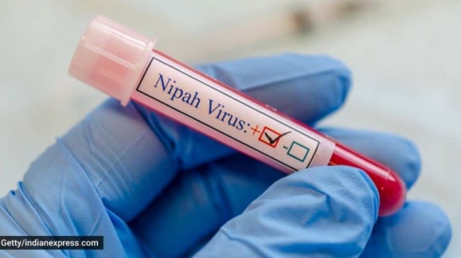 Virus Nipah