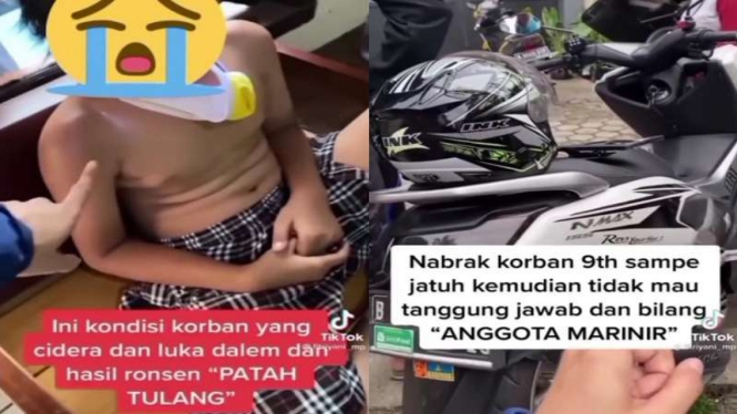 Bocah ditabrak pria mengaku anggota Marinir