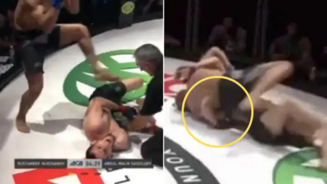 Petarung MMA, Abdul-Malik Saidulaev mengalami cedera lengan mengerikan.