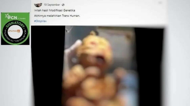 Tangkapan layar (screenshot) sebuah video yang memperlihatkan gambar yang disebut sebagai penampakan bayi hasil modifikasi genetika.