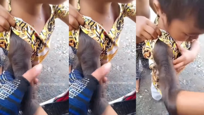 Viral Video Tangan Anak Ini Ditumbuhi Rambut Lebat