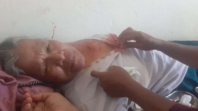Seorang perempuan lansia yang diduga terkena peluru aparat keamanan menjalani perawatan medis di Puskesmas Tamilou, Kecamatan Amahai, Kabupaten Maluku Tengah, Maluku, Selasa subuh, 7 Desember 2021.