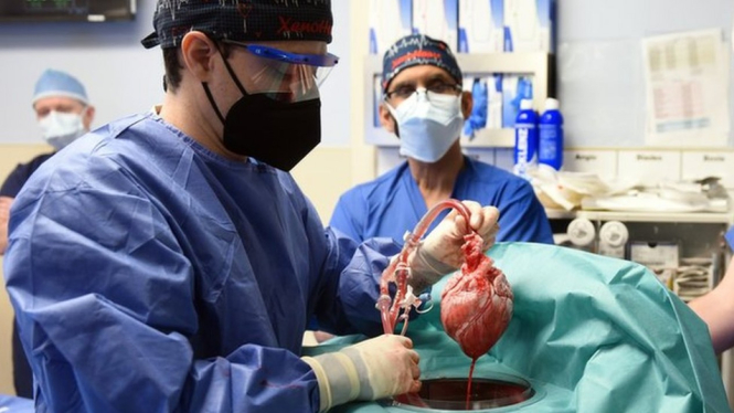 Transplantasi jantung babi ke manusia. UMSOM via BBC Indonesia