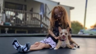 Diidap YouTuber Adalia Rose Sebelum Wafat, Ini Bahaya Sindrom Penuaan