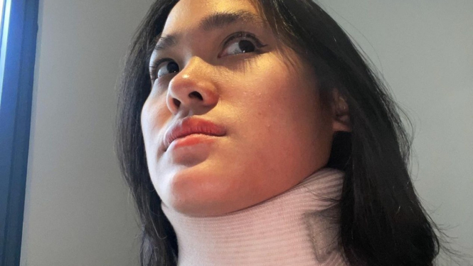 Foto Sheryl Sheinafia guanakan penyangga leher