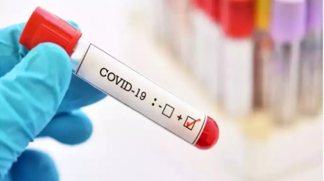 COVID-19 