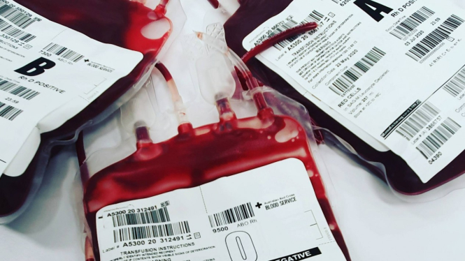Ilustrasi transfusi darah.